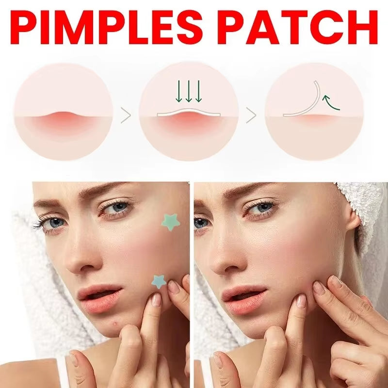 Acne Repair Patch - Fade Blemishes & Cover Pimple Marks for Clearer Skin